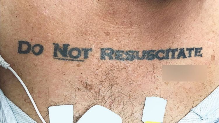 Лікарі відмовилися рятувати пацієнта через його татуювання на грудях
